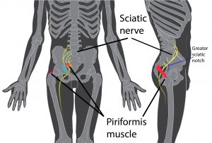 the piriformis muscle and the sciatic nerve